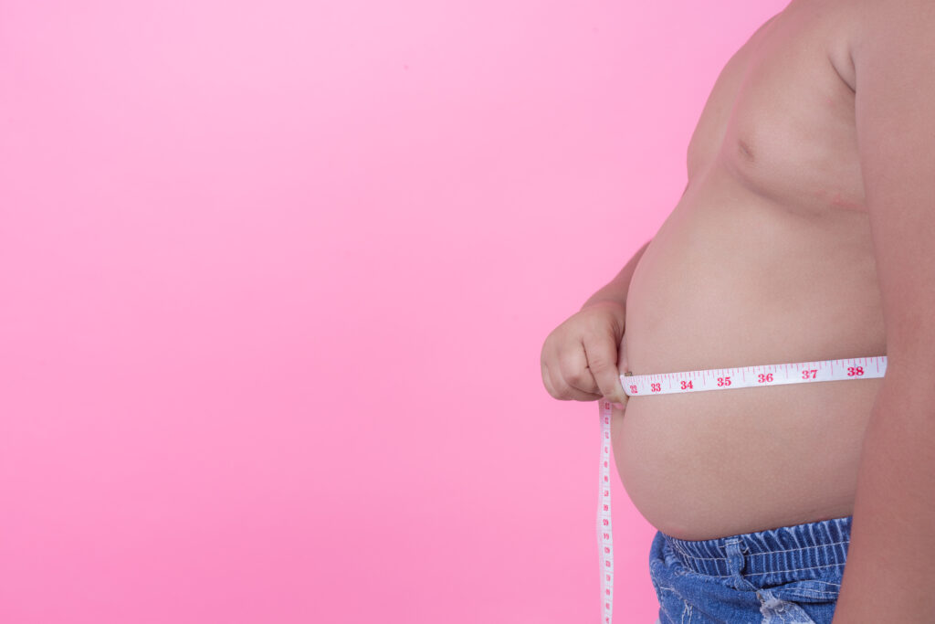 obesity and cortisone