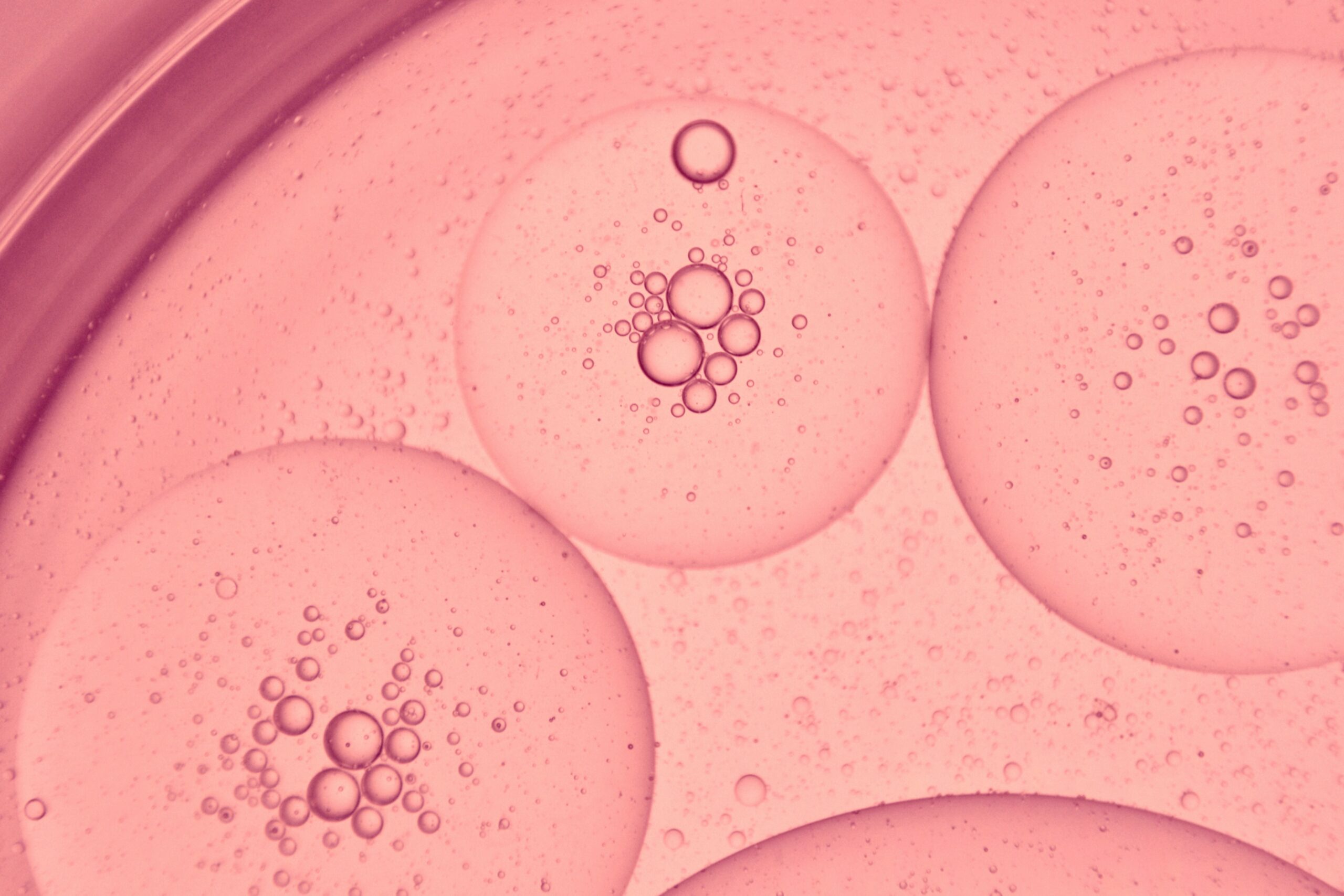 Pink bubbles and molecules in a petri dish. Scientists are using H202 in urine to predict breast cancer risk and severity. Photo by Luu Thanh Truc.